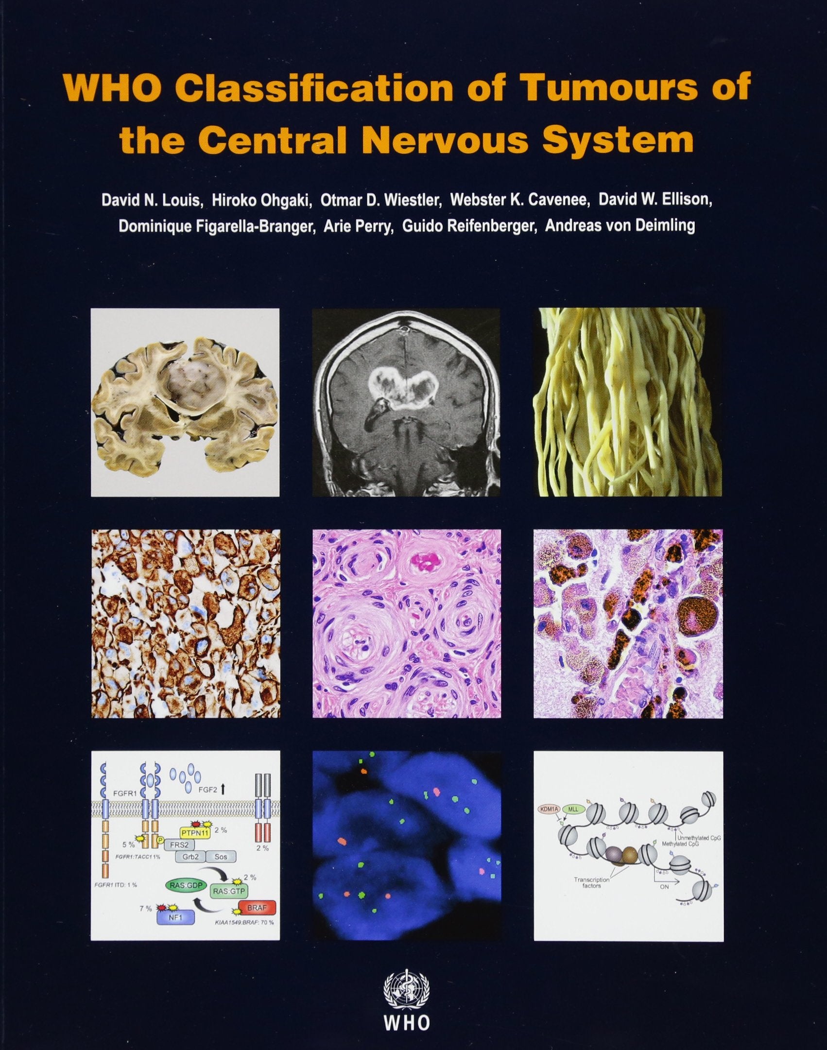 WHO Classification of Tumours of the Central Nervous System [OP],New