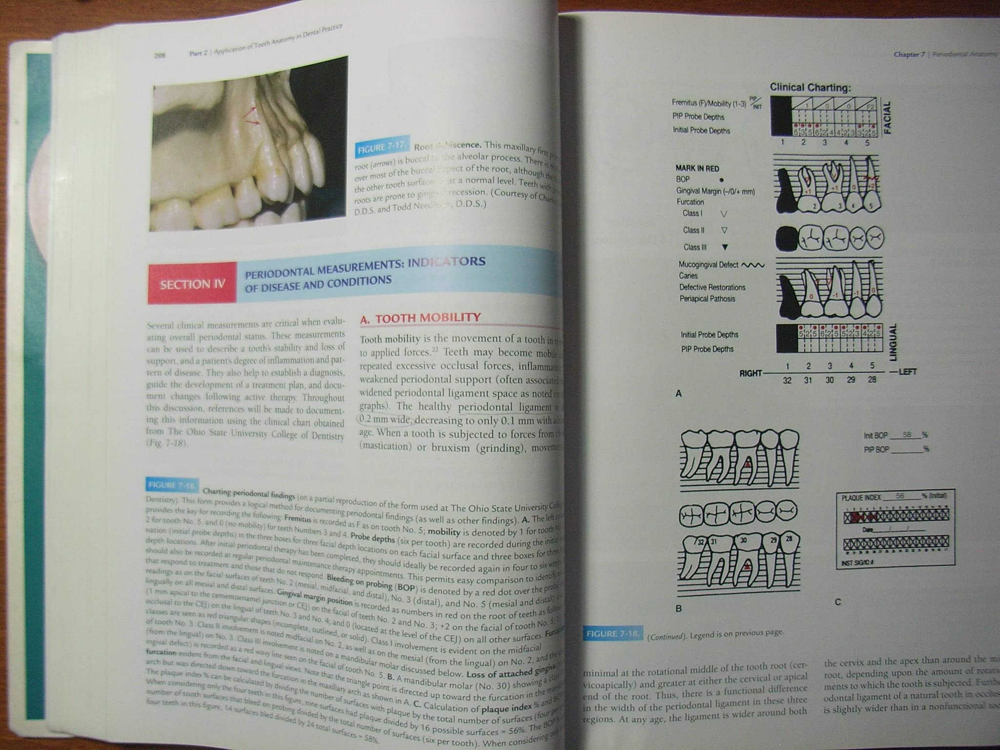 Woelfel's Dental Anatomy,Used