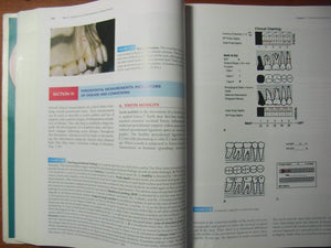 Woelfel's Dental Anatomy,Used