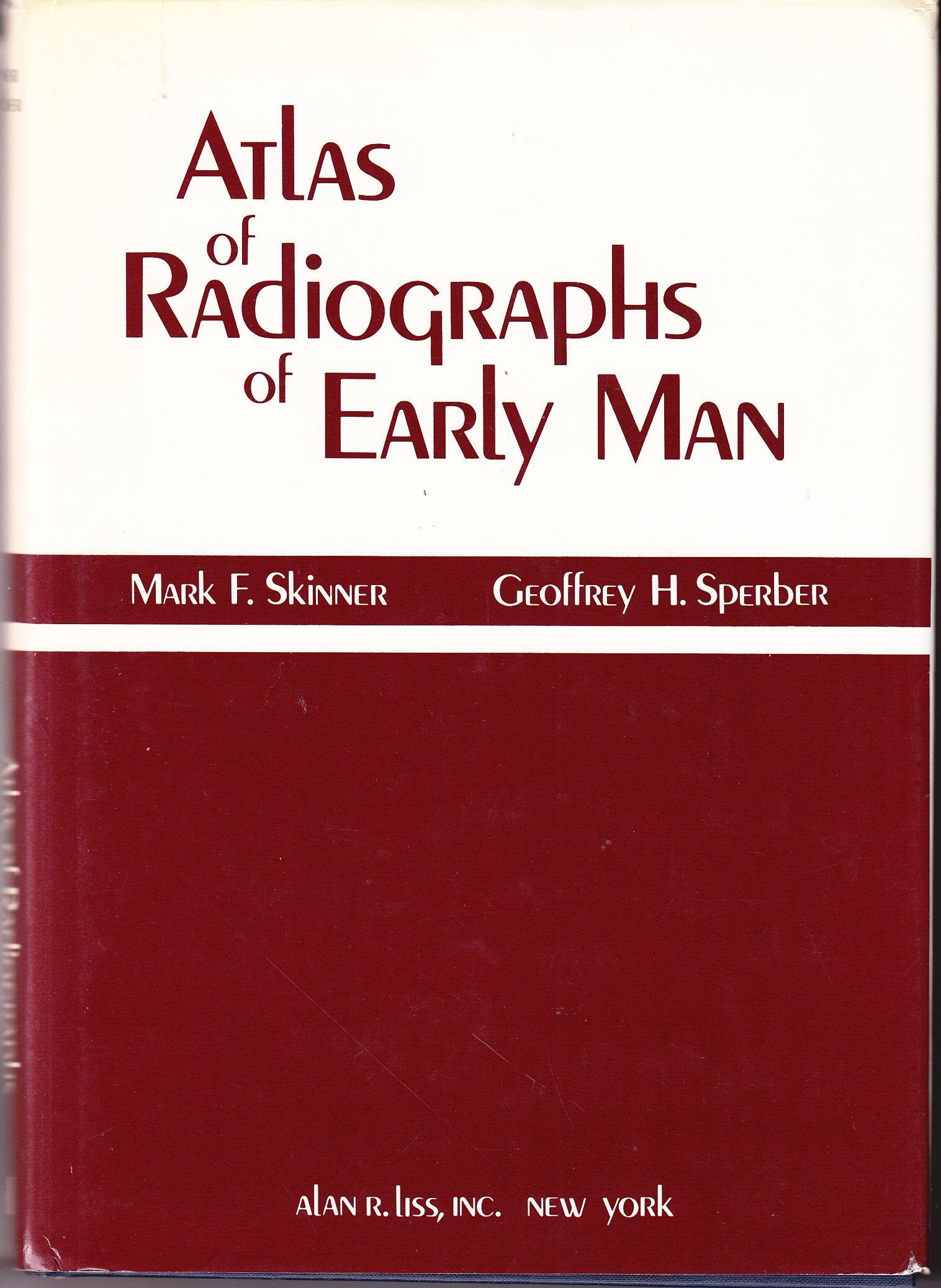 Atlas of radiographs of early man,Used