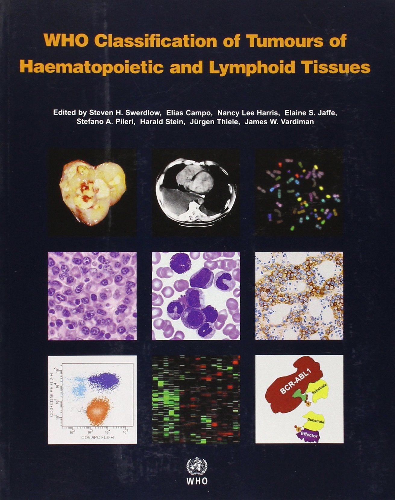 WHO Classification of Tumours of Haematopoietic and Lymphoid Tissue [OP] (Medicine),Used