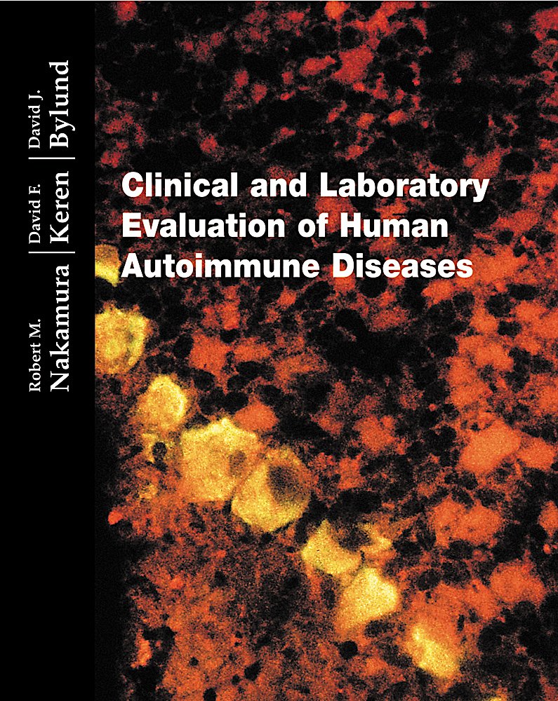 Clinical and Evaluation of Human Autoimmune Diseases,Used
