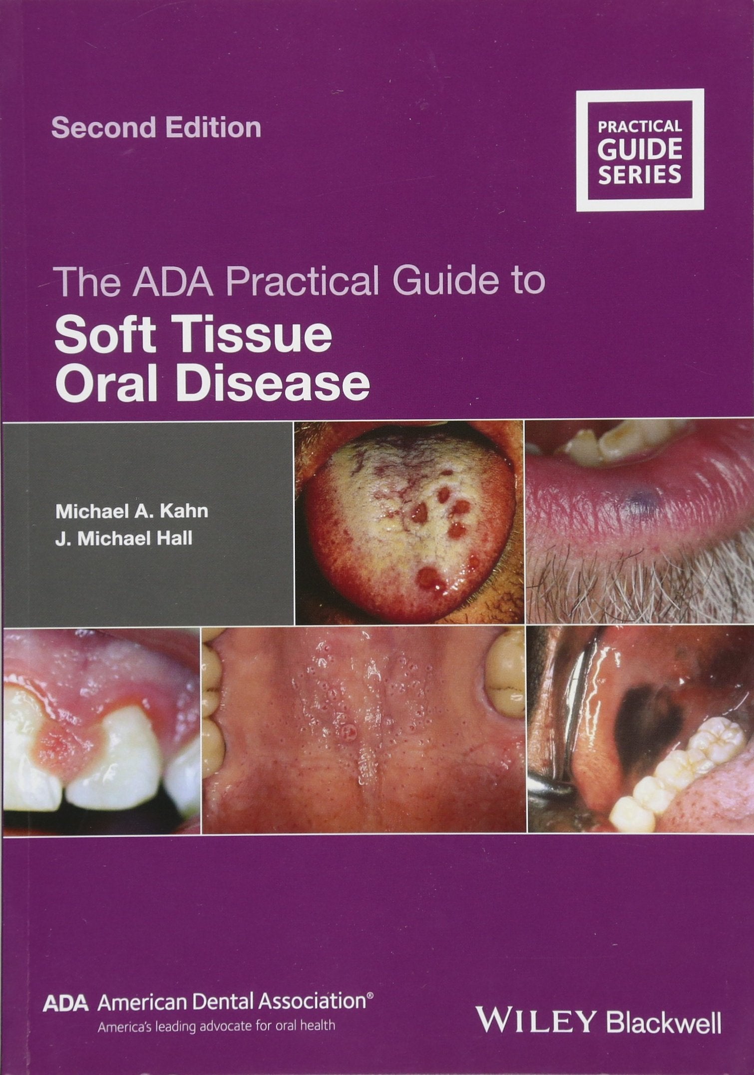 The ADA Practical Guide to Soft Tissue Oral Disease, 2nd Edition,Used