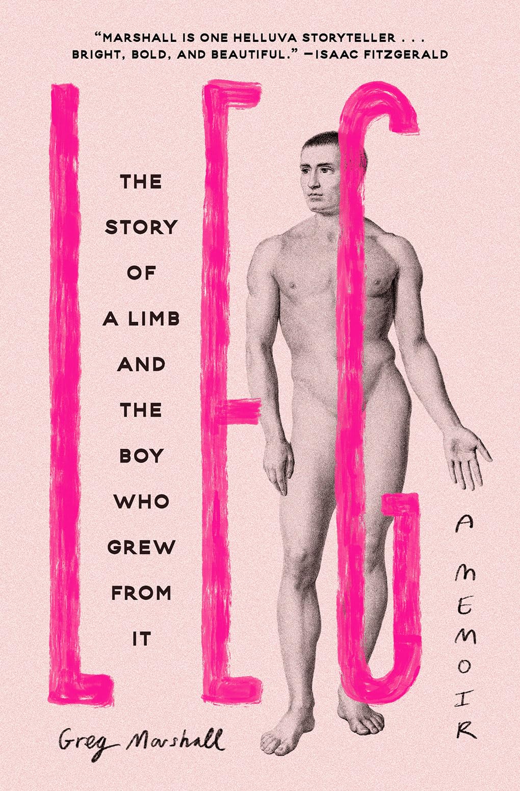 Leg: The Story Of A Limb And The Boy Who Grew From It,Used