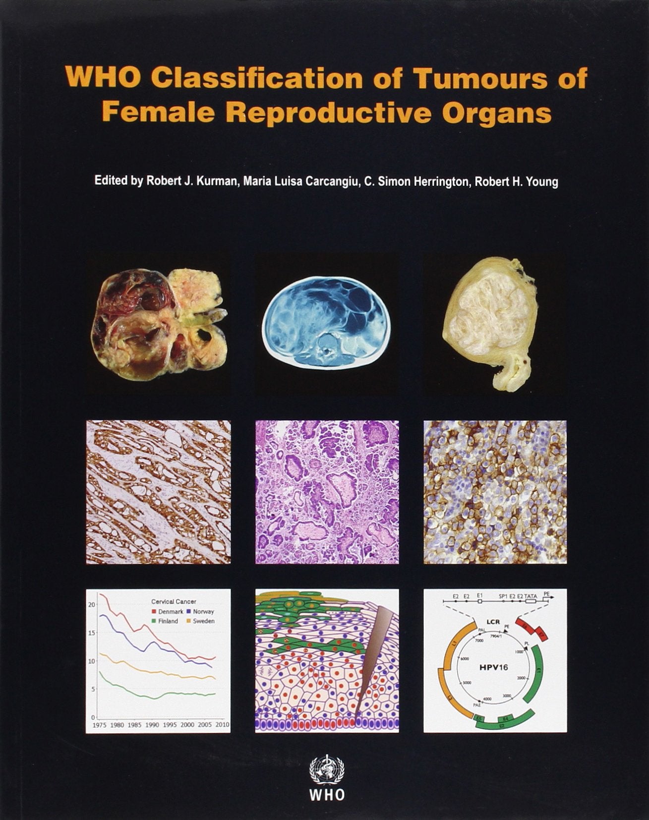 WHO Classification of Tumours of the Female Reproductive Organs [OP] (Medicine),Used