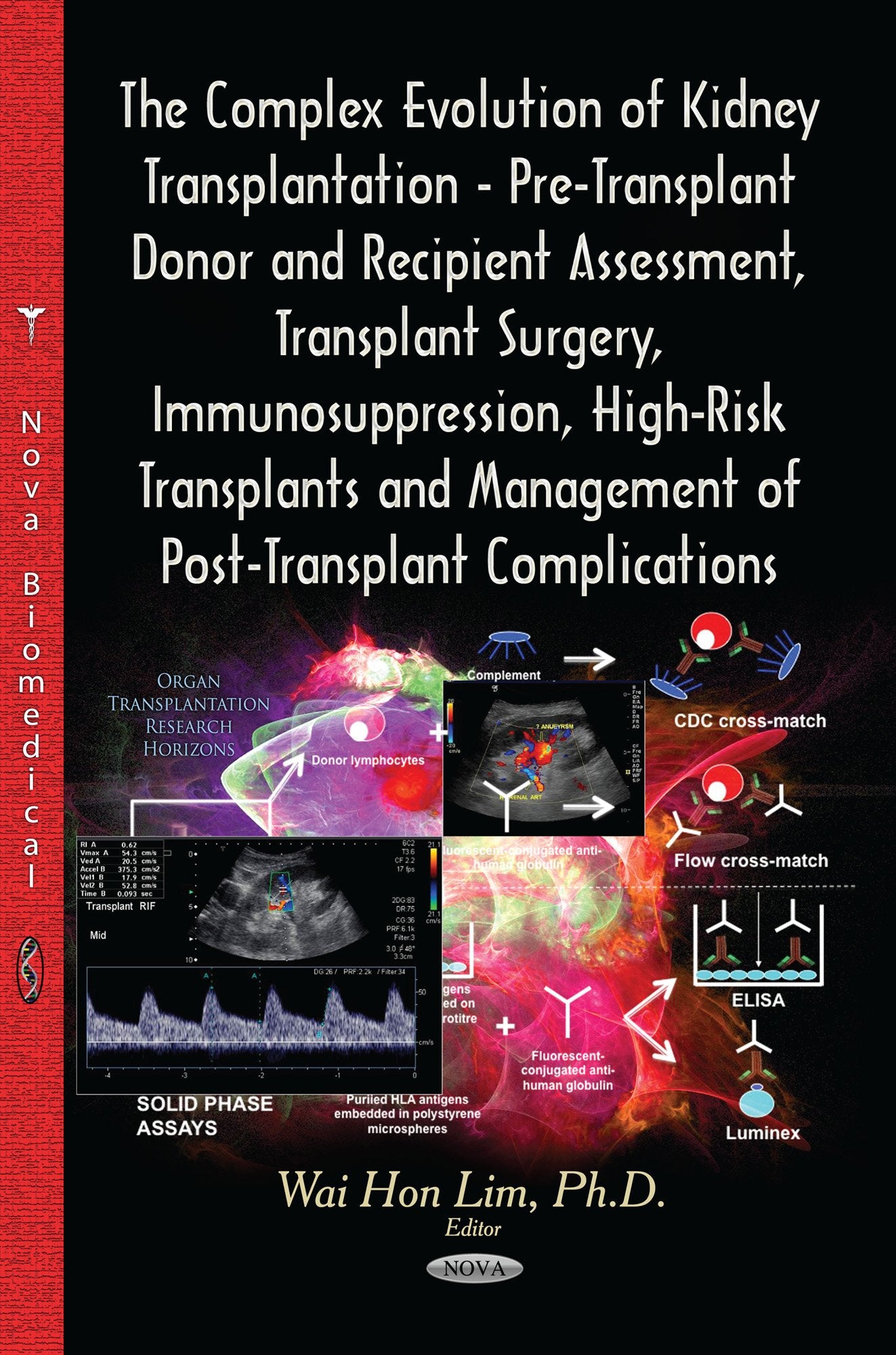 The Complex Evolution of Kidney Transplantation: PreTransplant Donor and Recipient Assessment, Transplant Surgery, Immunosuppre,Used