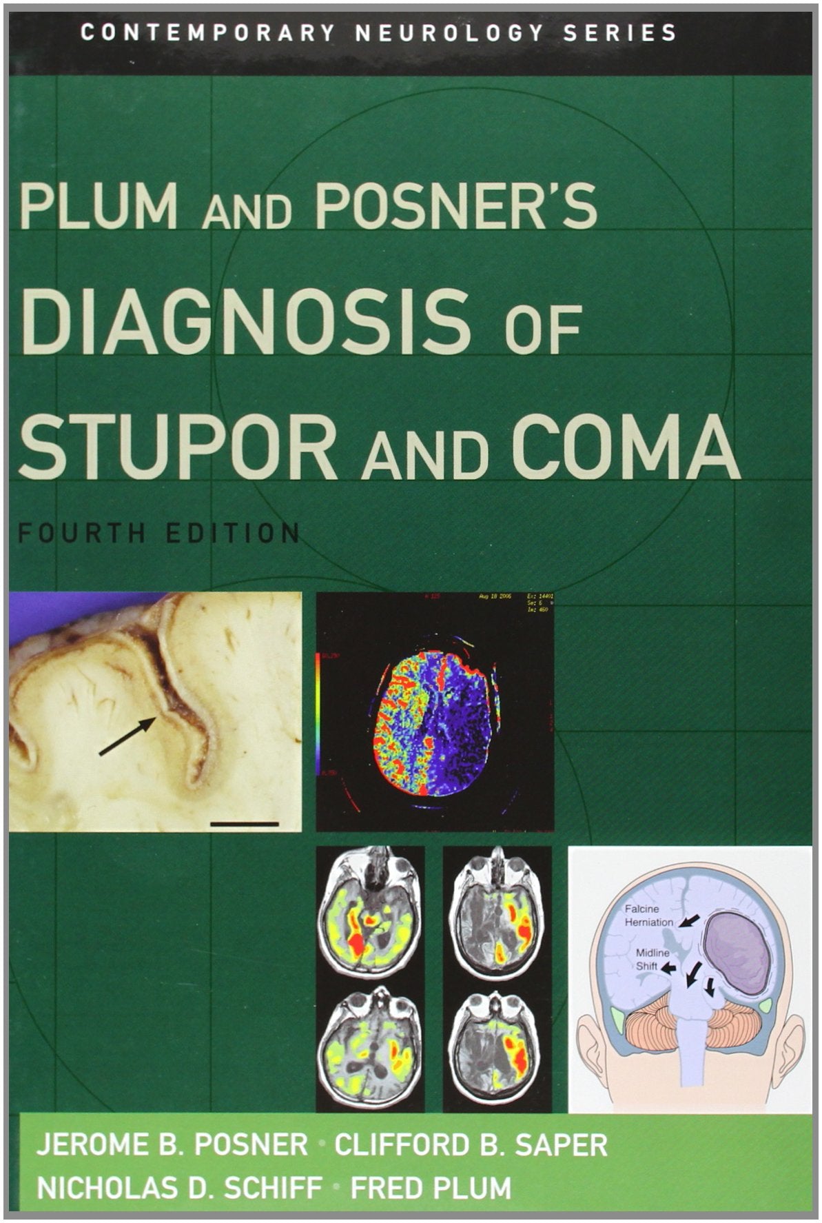 Plum and Posner's Diagnosis of Stupor and Coma (Contemporary Neurology Series),Used