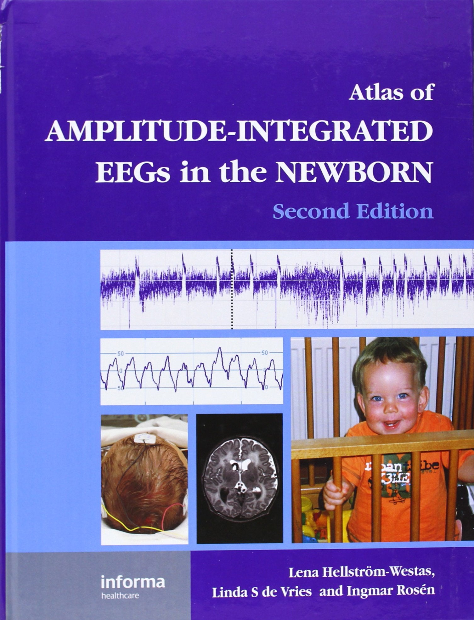 An Atlas of AmplitudeIntegrated EEGs in the Newborn (Encyclopedia of Visual Medicine Series),Used