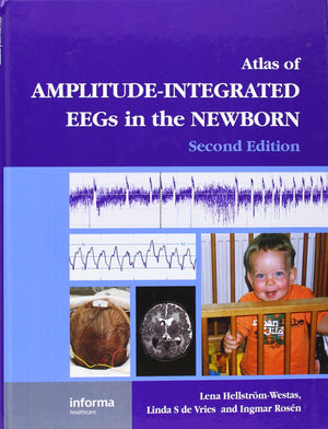 An Atlas of AmplitudeIntegrated EEGs in the Newborn (Encyclopedia of Visual Medicine Series),Used