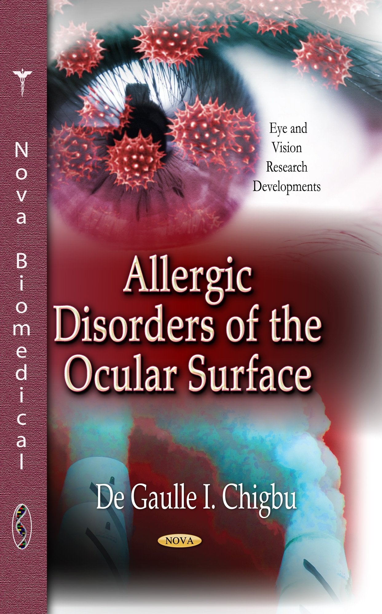 Allergic Disorders of the Ocular Surface (Eye and Vision Research Developments),Used