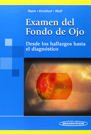 Examen del Fondo de Ojo. Desde los hallazgos hasta el diagnstico (Spanish Edition),Used