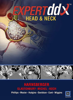 Expertddx Head and Neck,Used