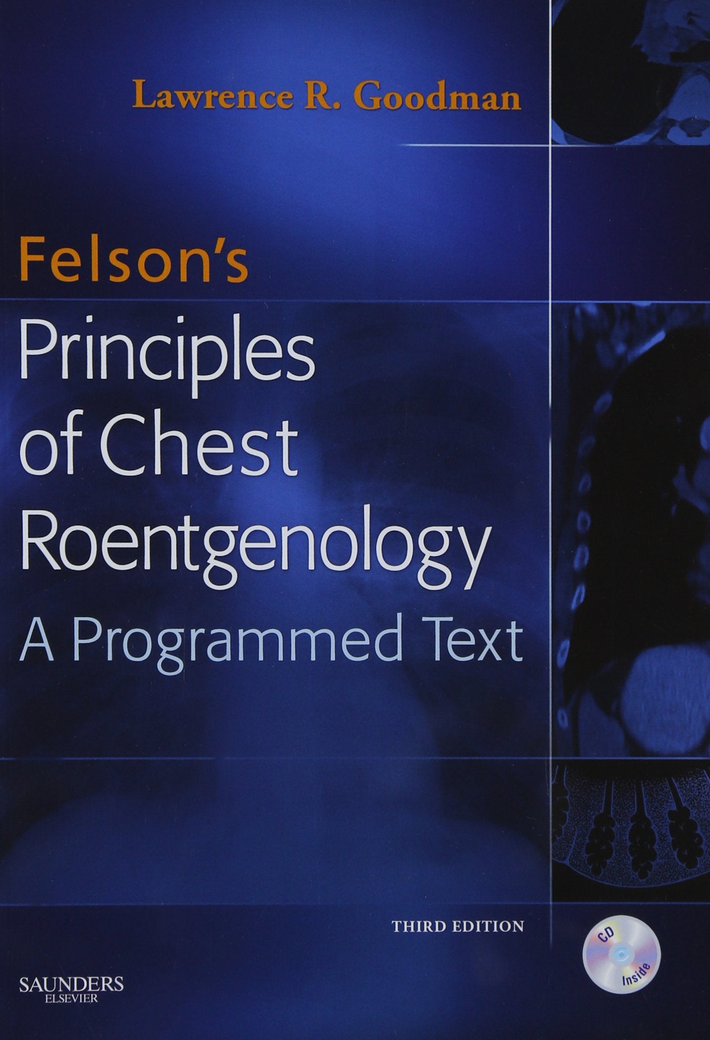 Felson'S Principles Of Chest Roentgenology Text With Cdrom