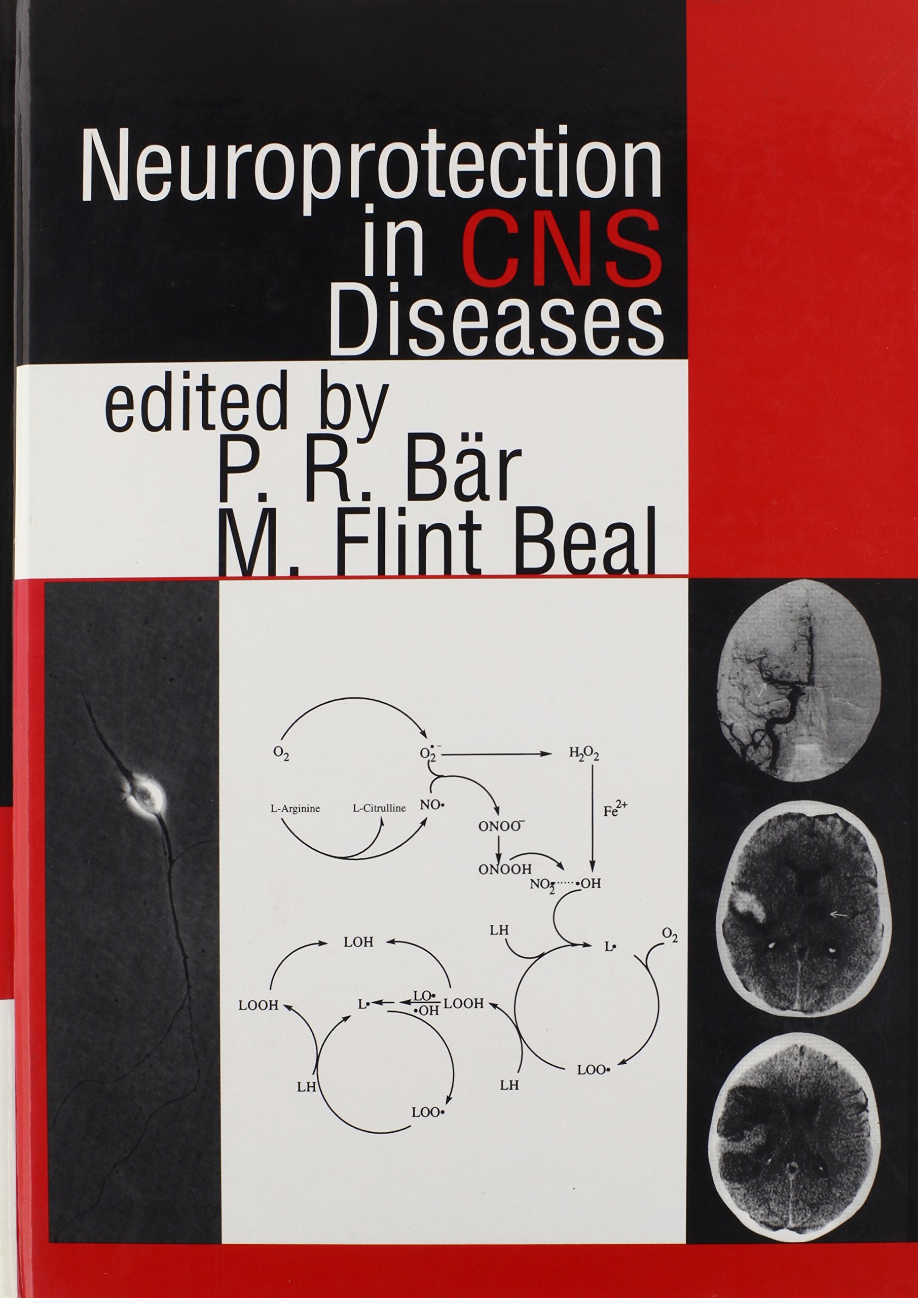 Neuroprotection In Cns Diseases,Used