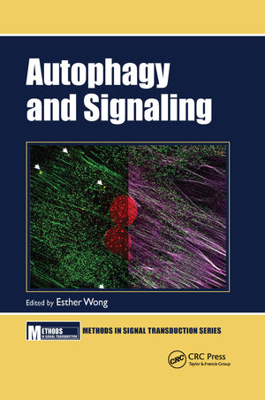 Autophagy and Signaling (Methods in Signal Transduction Series),Used