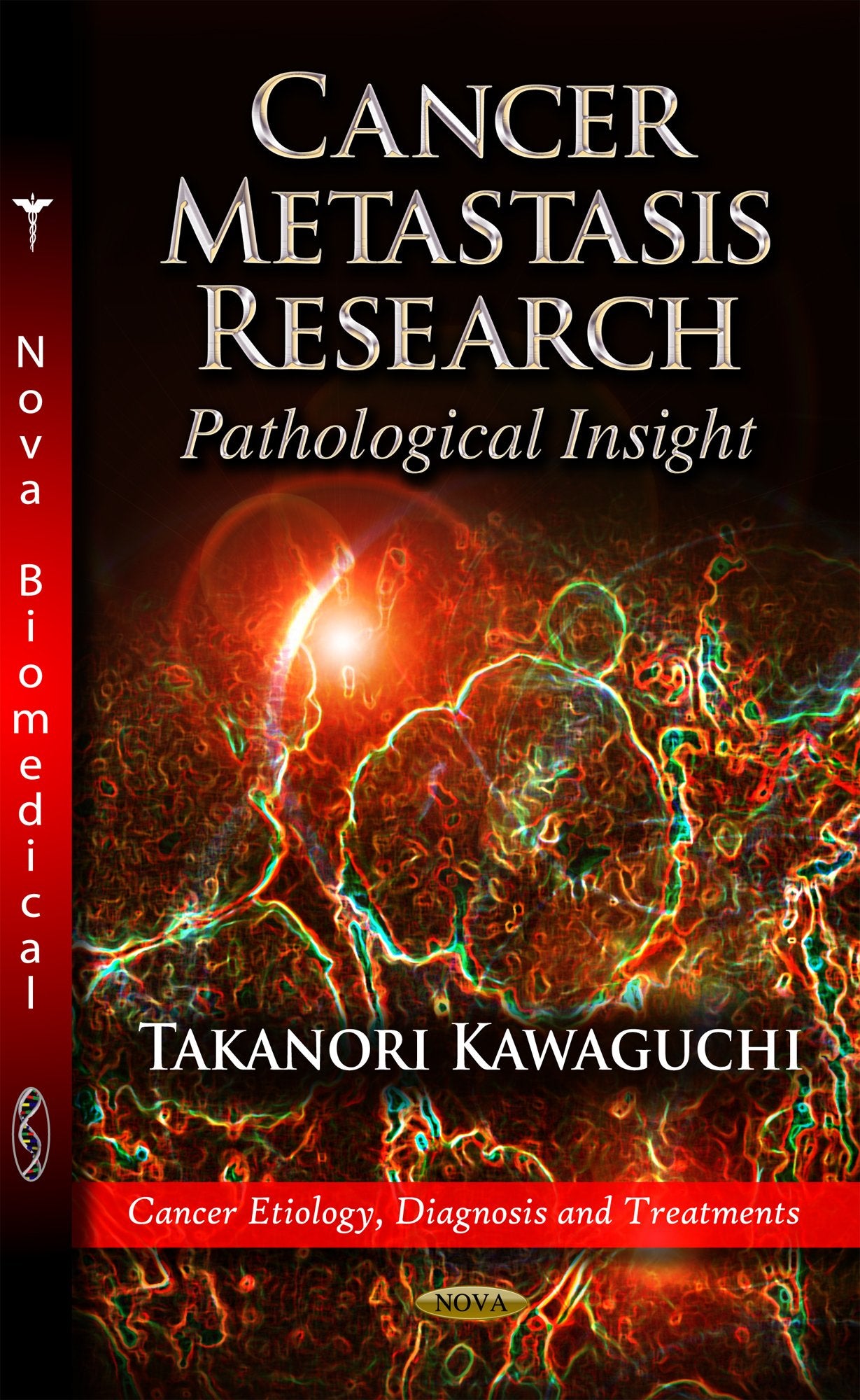 Cancer Metastasis Research: Pathological Insight (Cancer Etiology, Diagnosis And Treatments),Used