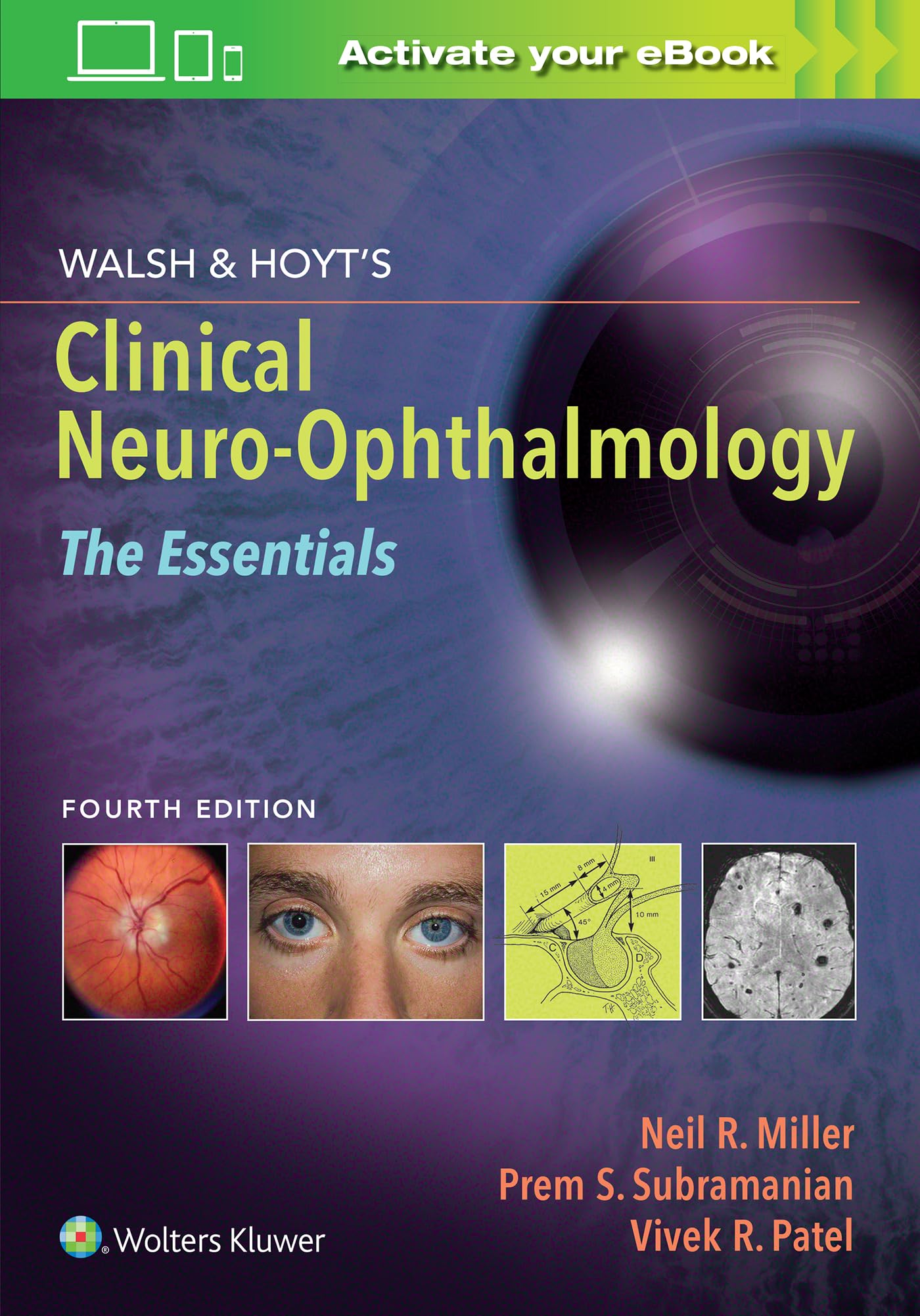 Walsh & Hoyt's Clinical NeuroOphthalmology: The Essentials,Used