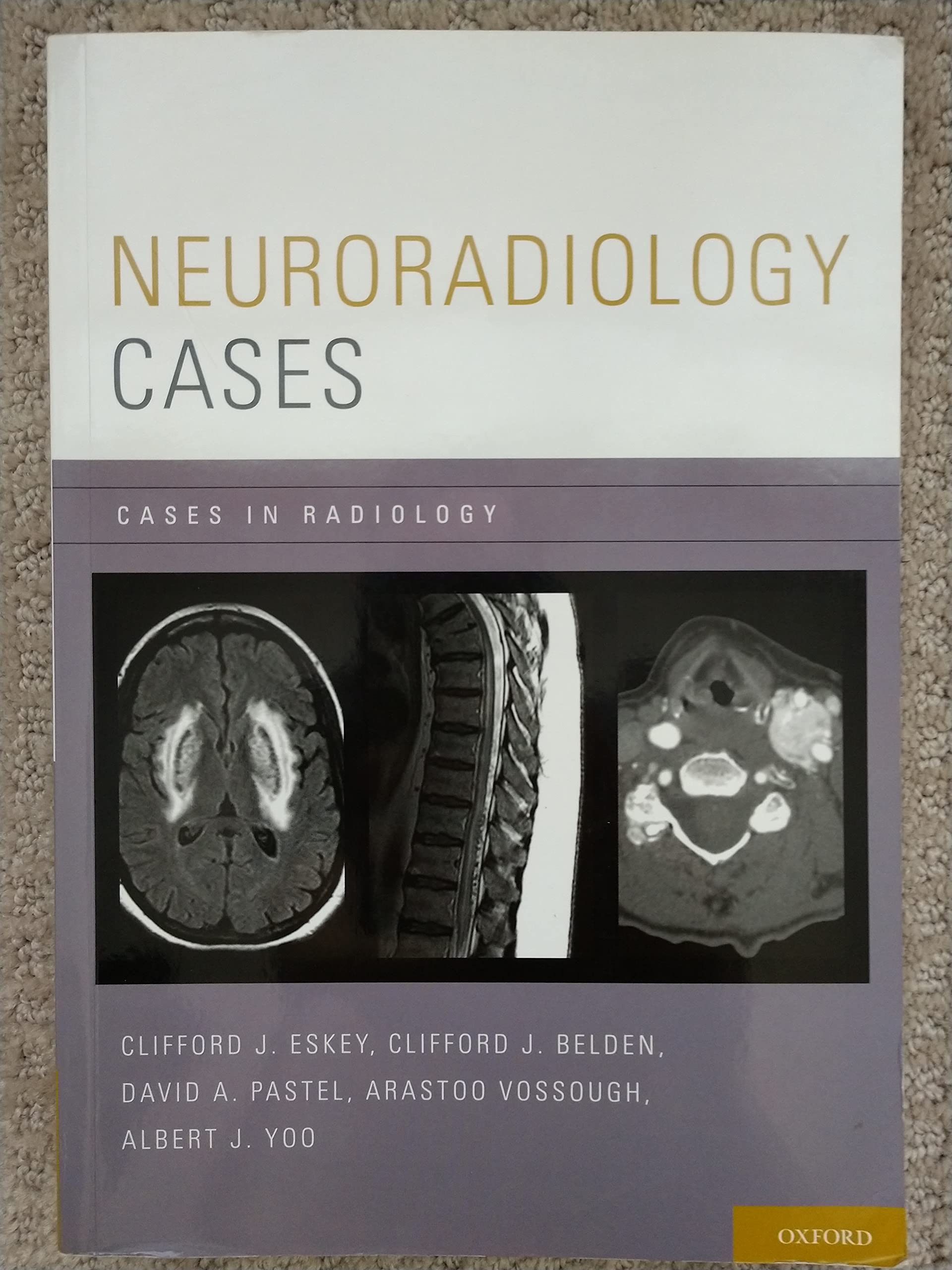 Neuroradiology Cases (Cases in Radiology),Used
