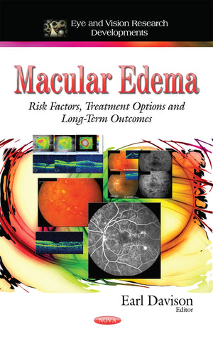 Macular Edema: Risk Factors, Treatment Options and LongTerm Outcomes (Eye and Vision Research Developments),Used