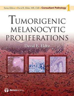 Consultant Pathology: Tumorigenic Melanocytic Proliferations,Used