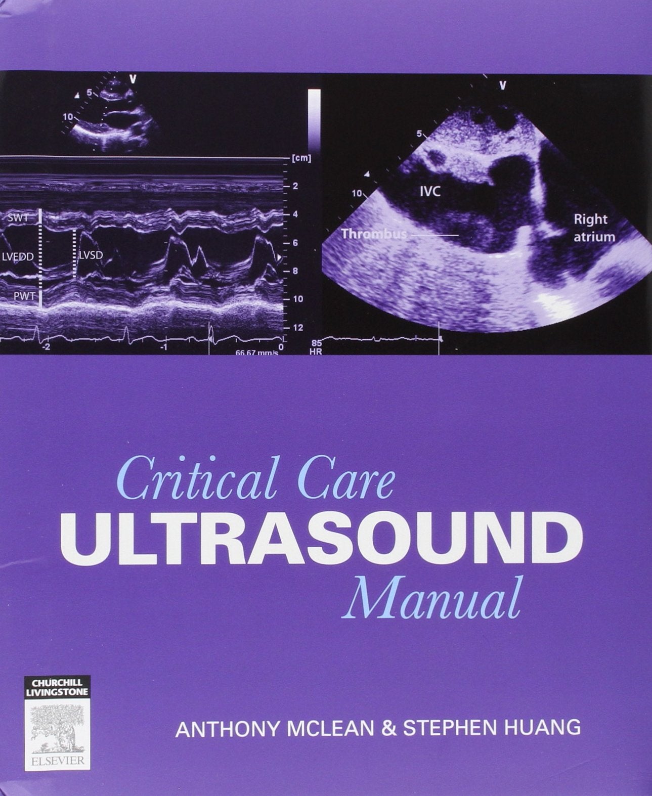 Critical Care Ultrasound Manual,Used