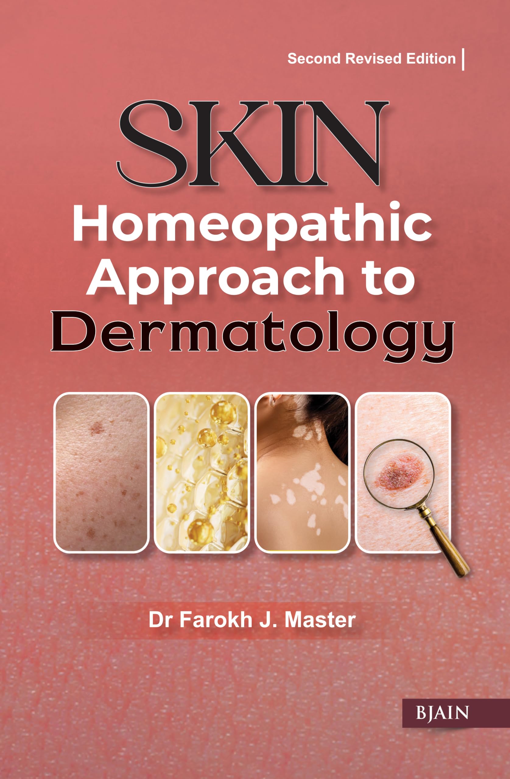 Skin Homeopathic Approach To Dermatology  Second Revised Edition
