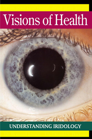 Visions of Health : Understanding Iridology,Used