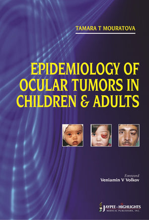 Epidemiology Of Ocular Tumors In Children And Adults,Used