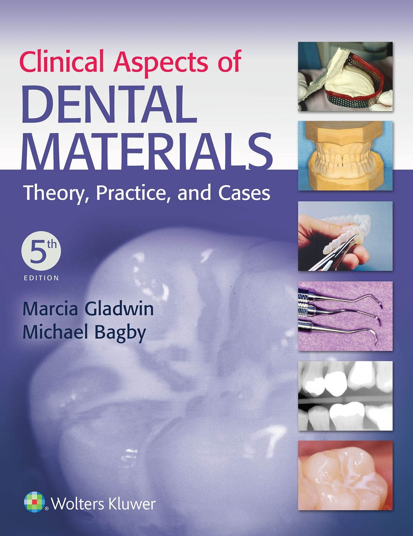 Clinical Aspects of Dental Materials,Used