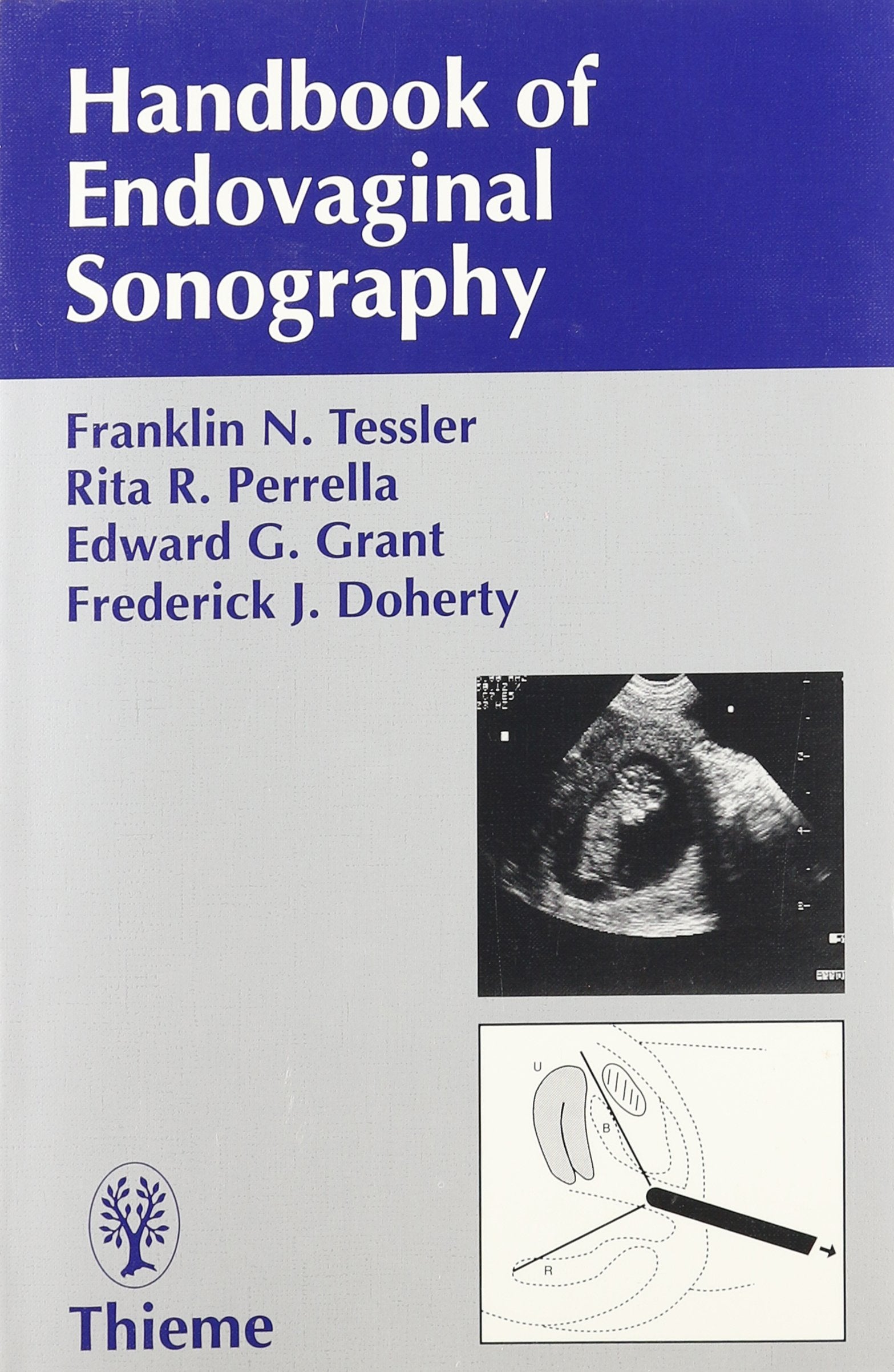 Handbook Of Endovaginal Sonography,Used