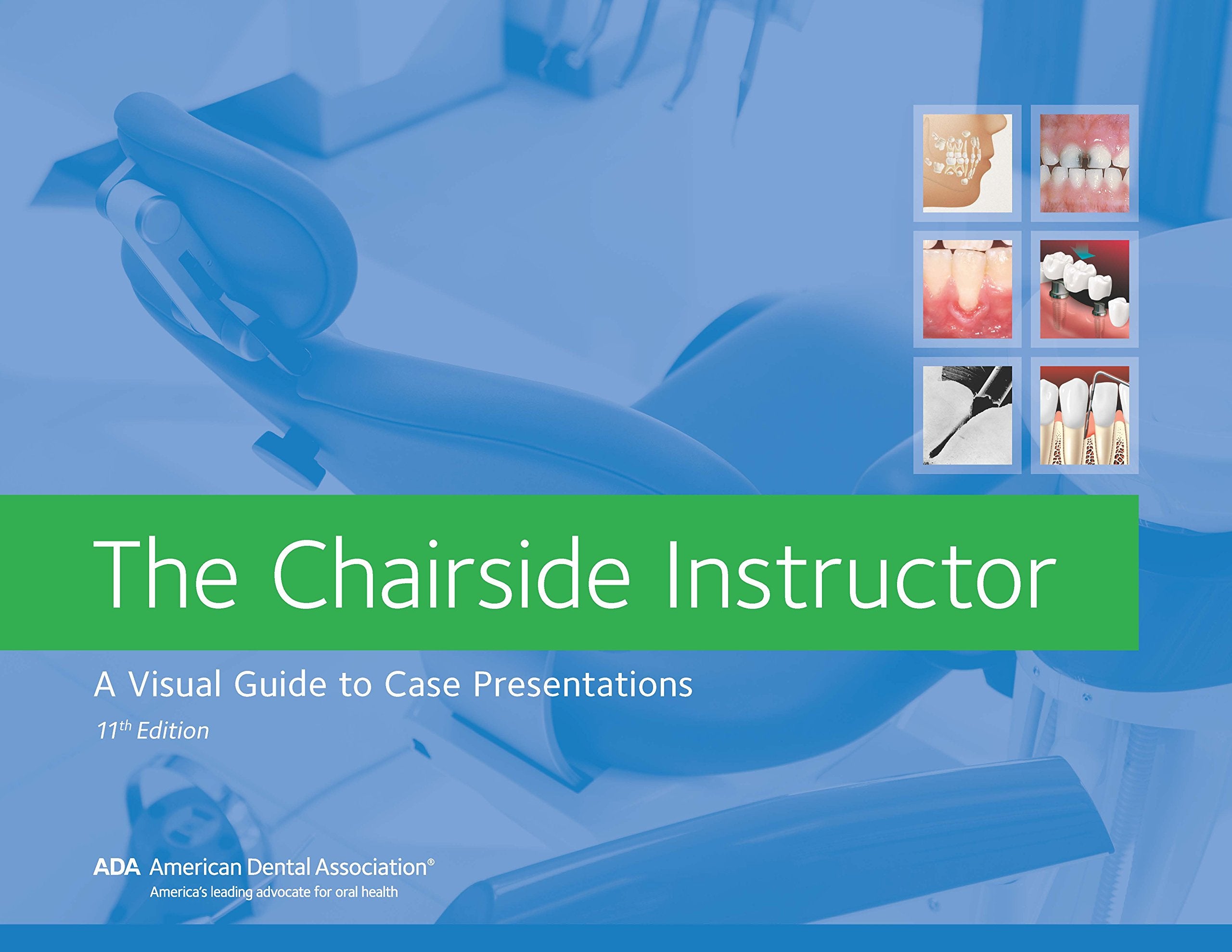 The Chairside Instructor: A Visual Guide to Case Presentations,Used