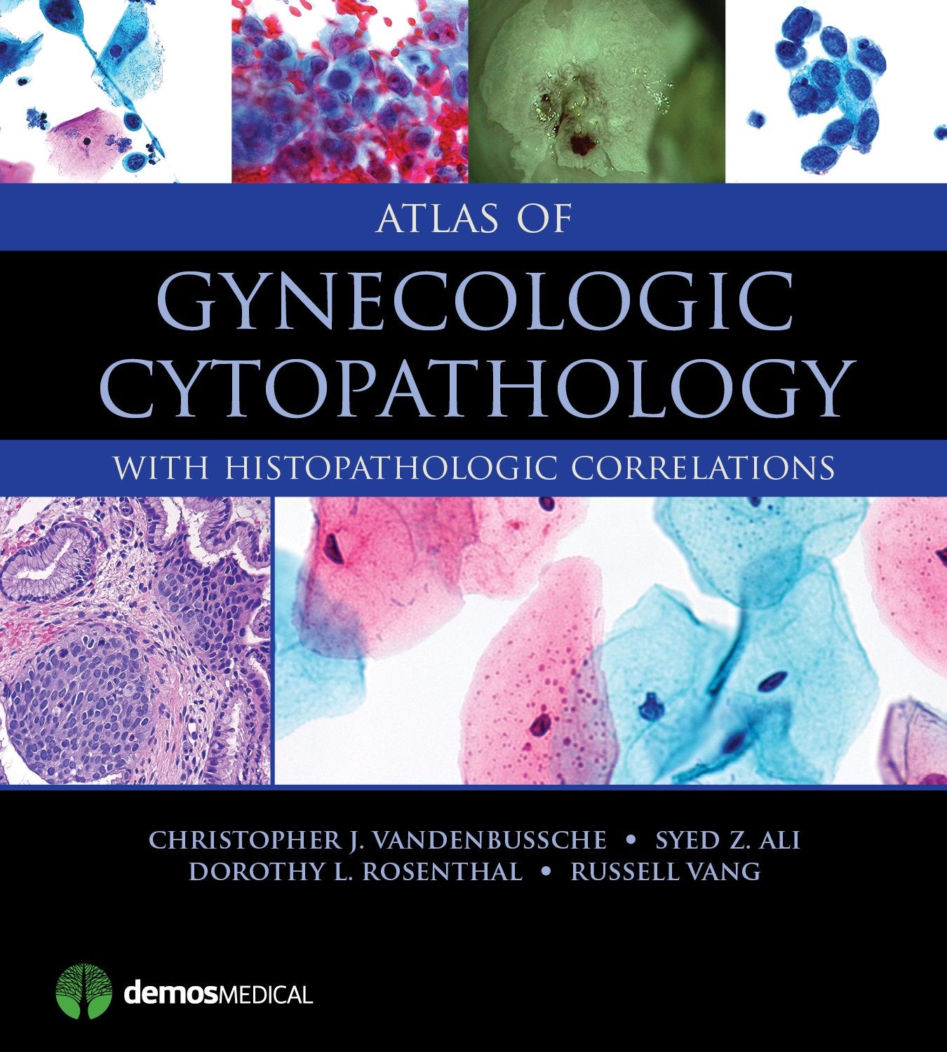 Atlas of Gynecologic Cytopathology: with Histopathologic Correlations,Used