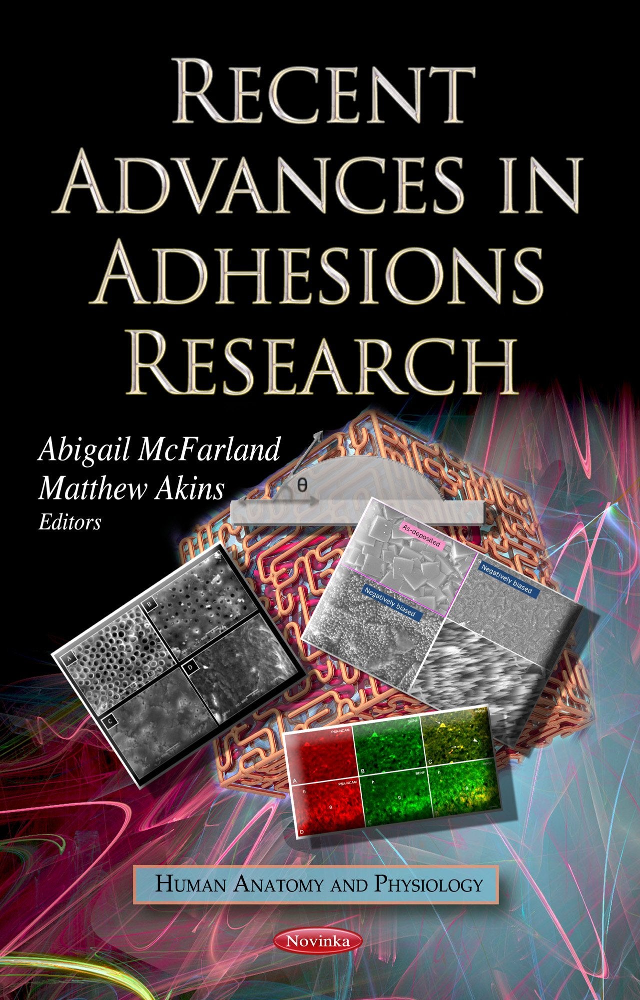 Recent Advances In Adhesions Research (Human Anatomy And Physiology),Used