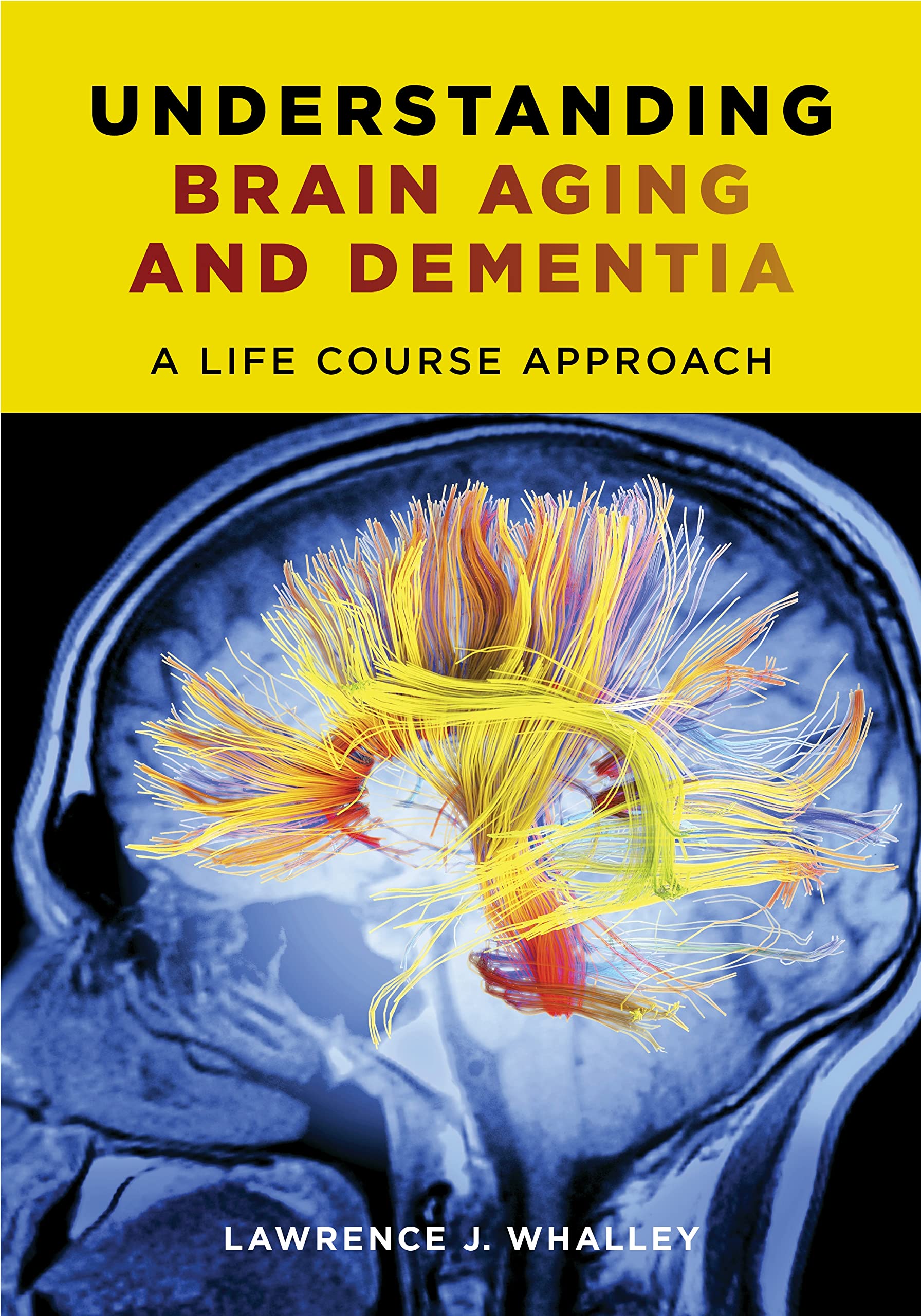 Understanding Brain Aging And Dementia: A Life Course Approach