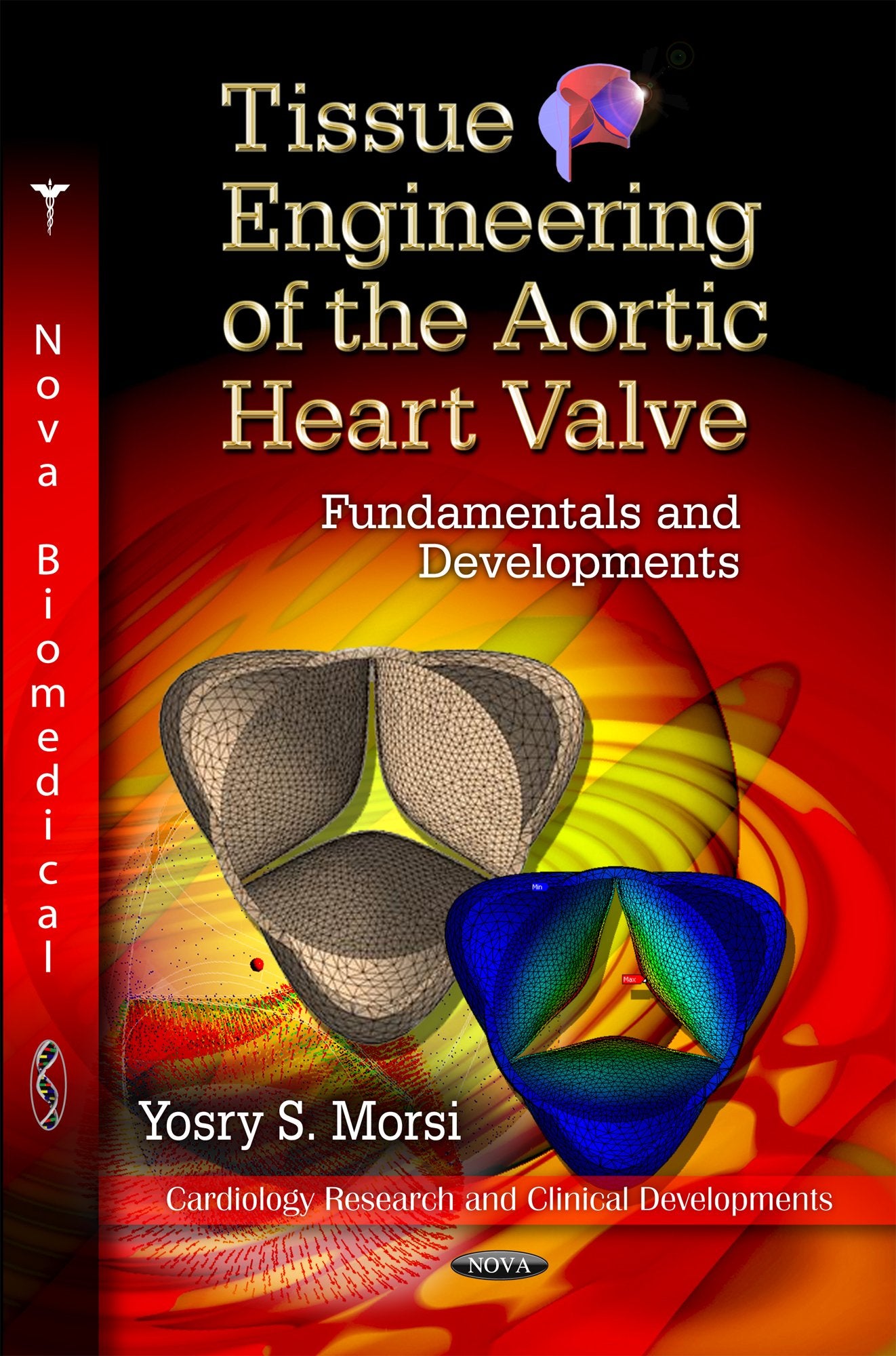 Tissue Engineering Of The Aortic Heart Valve: Fundamentals And Developments (Cardiology Research And Clincal Developments),Used