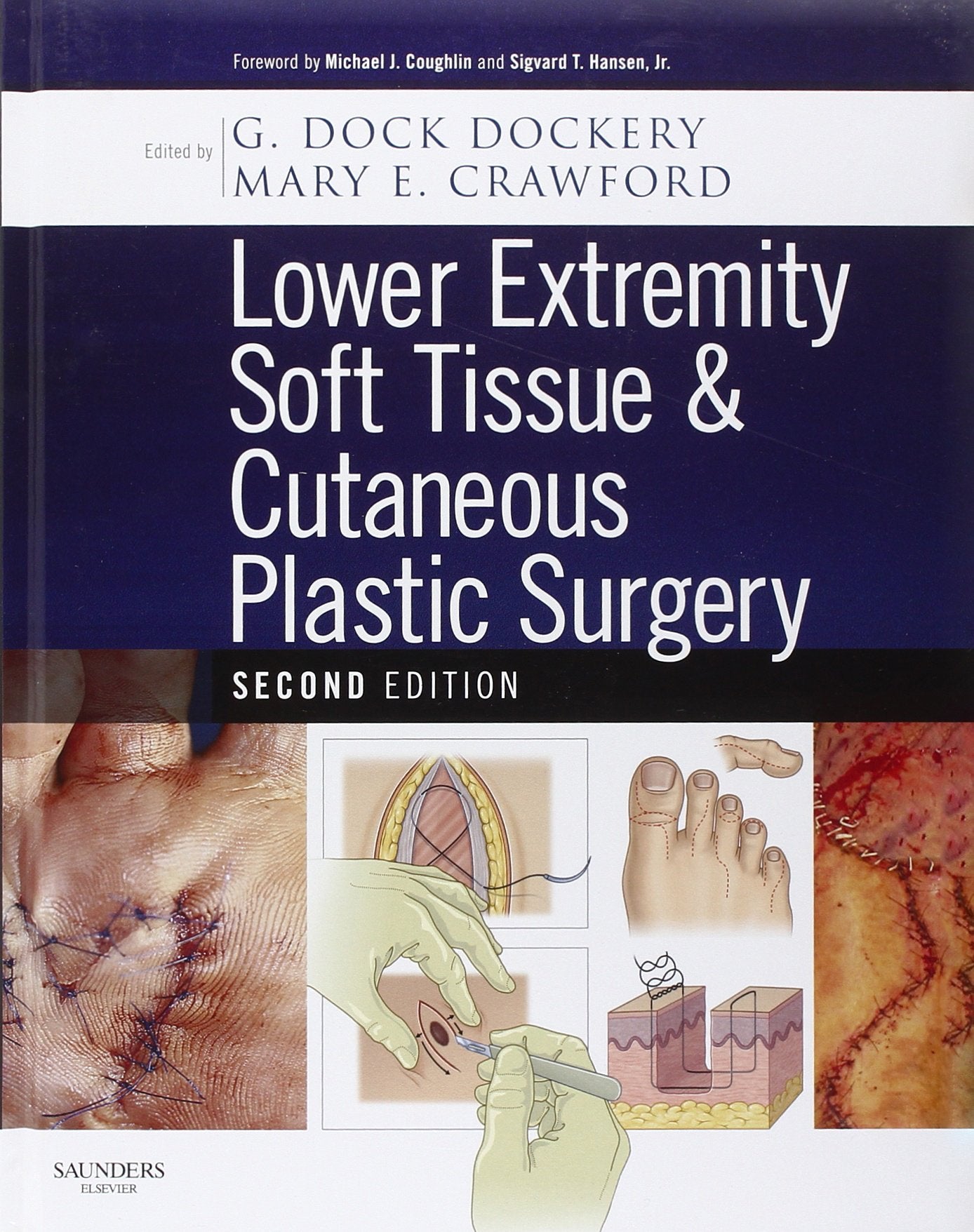 Lower Extremity Soft Tissue & Cutaneous Plastic Surgery,Used