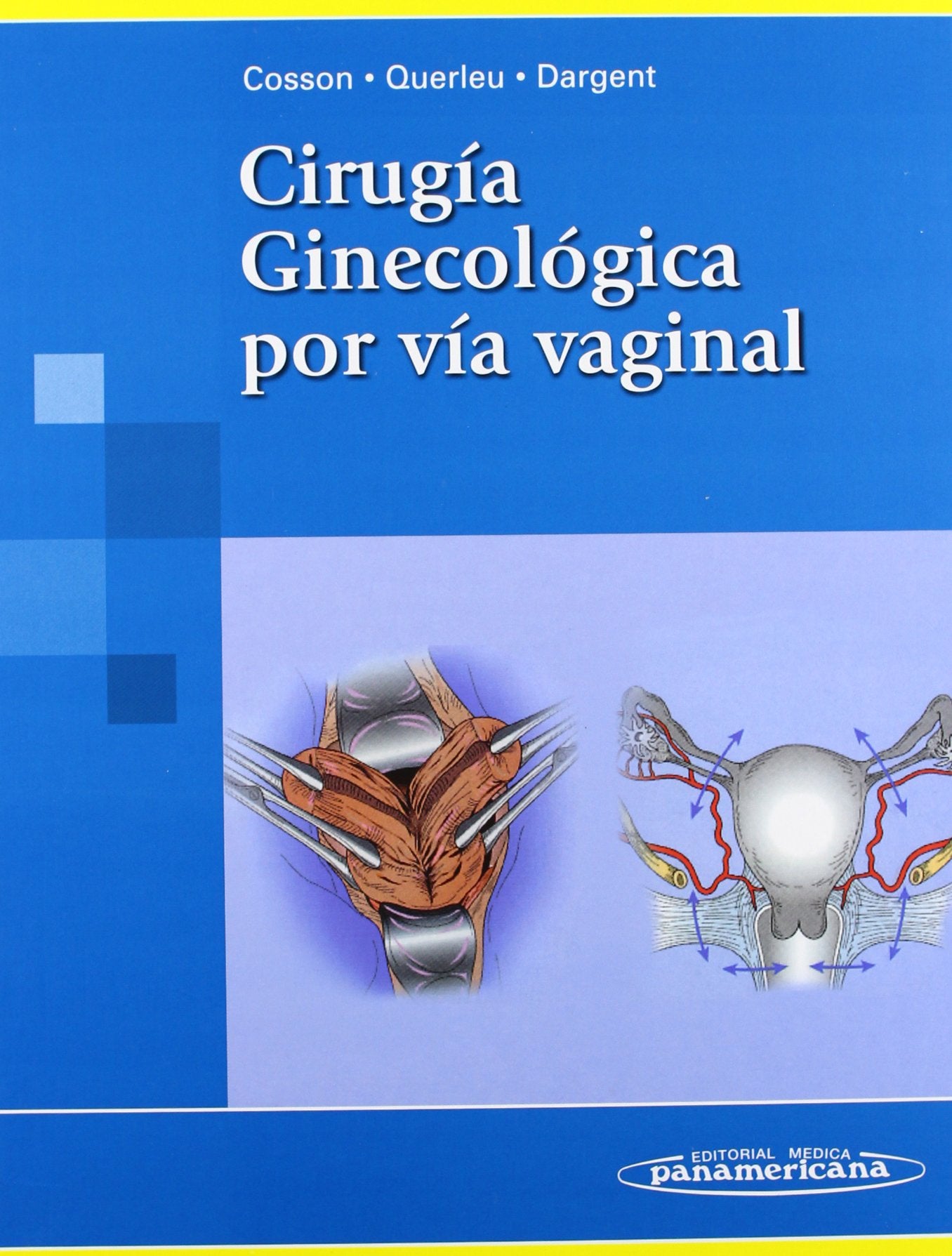 Ciruga Vaginal (Spanish Edition),Used