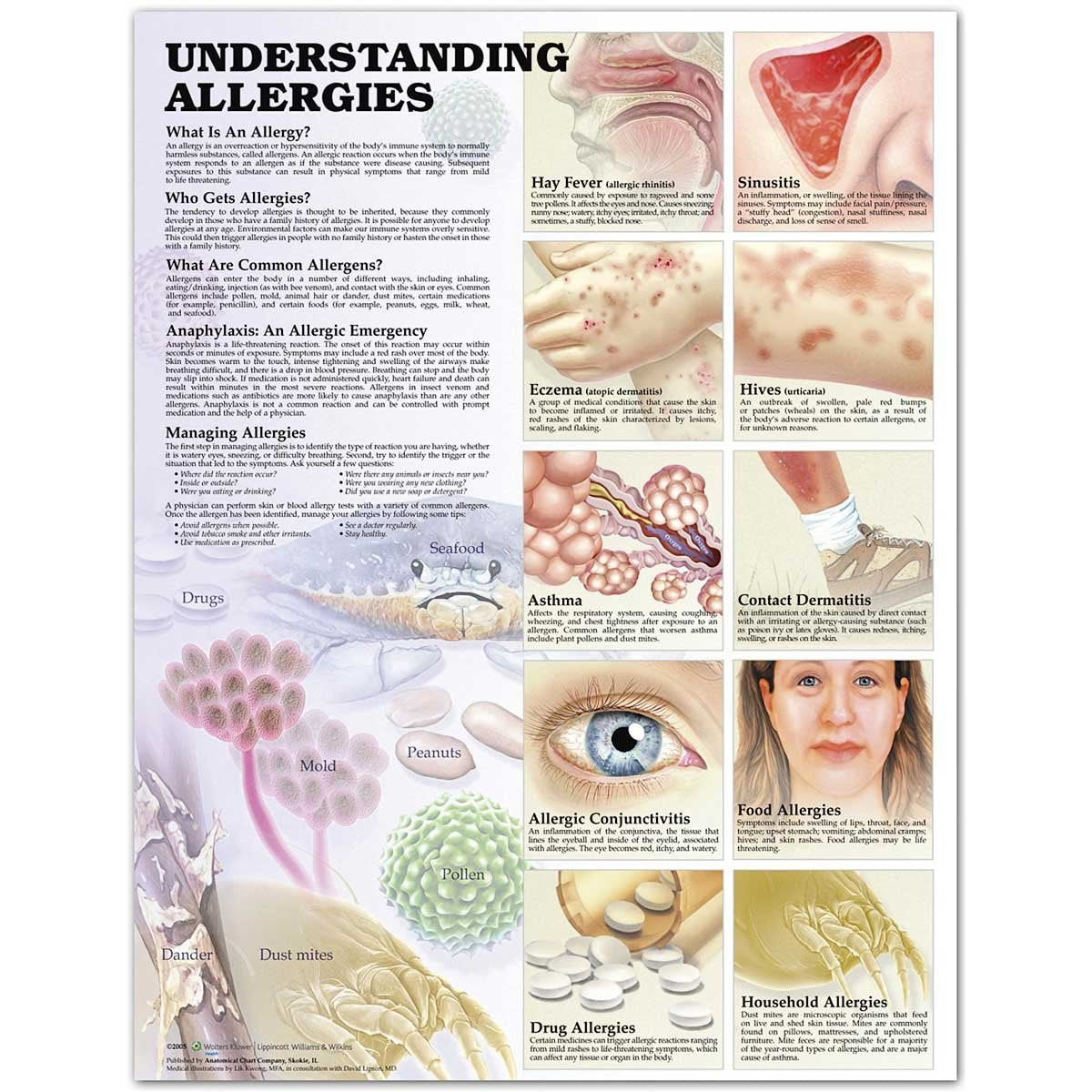 Understanding Allergies Anatomical Chart,New