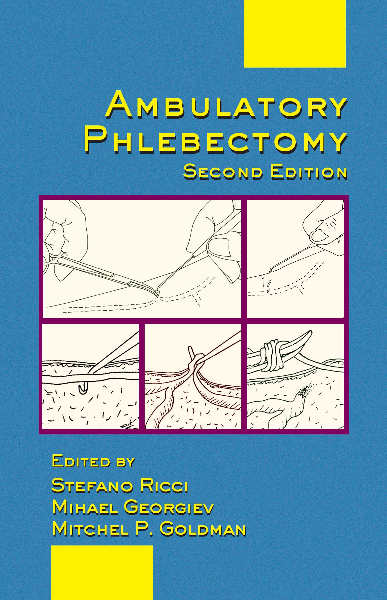 Ambulatory Phlebectomy (Basic and Clinical Dermatology),Used