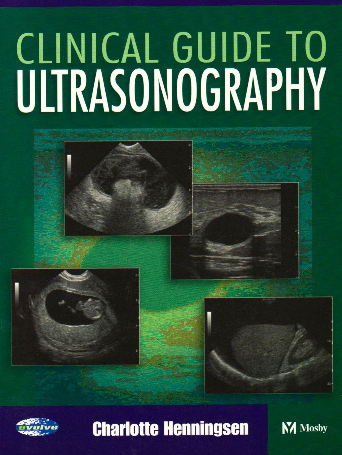 Clinical Guide To Ultrasonography,New