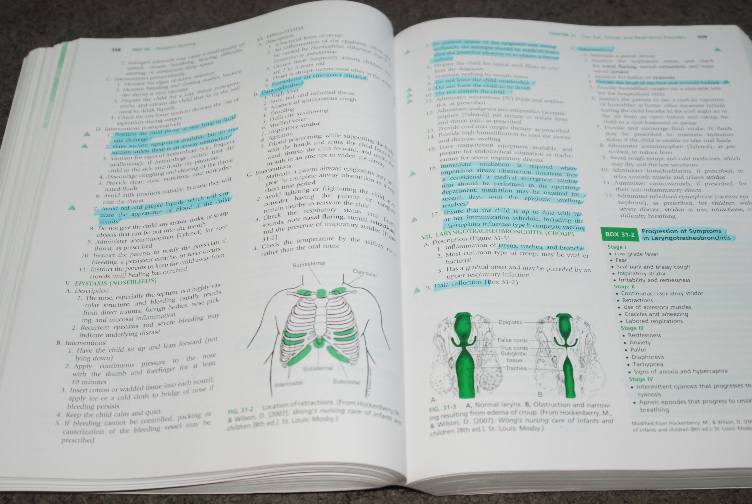 Saunders Comprehensive Review for the NCLEXPN Examination (Saunders Comprehensive Review for NclexPn),Used