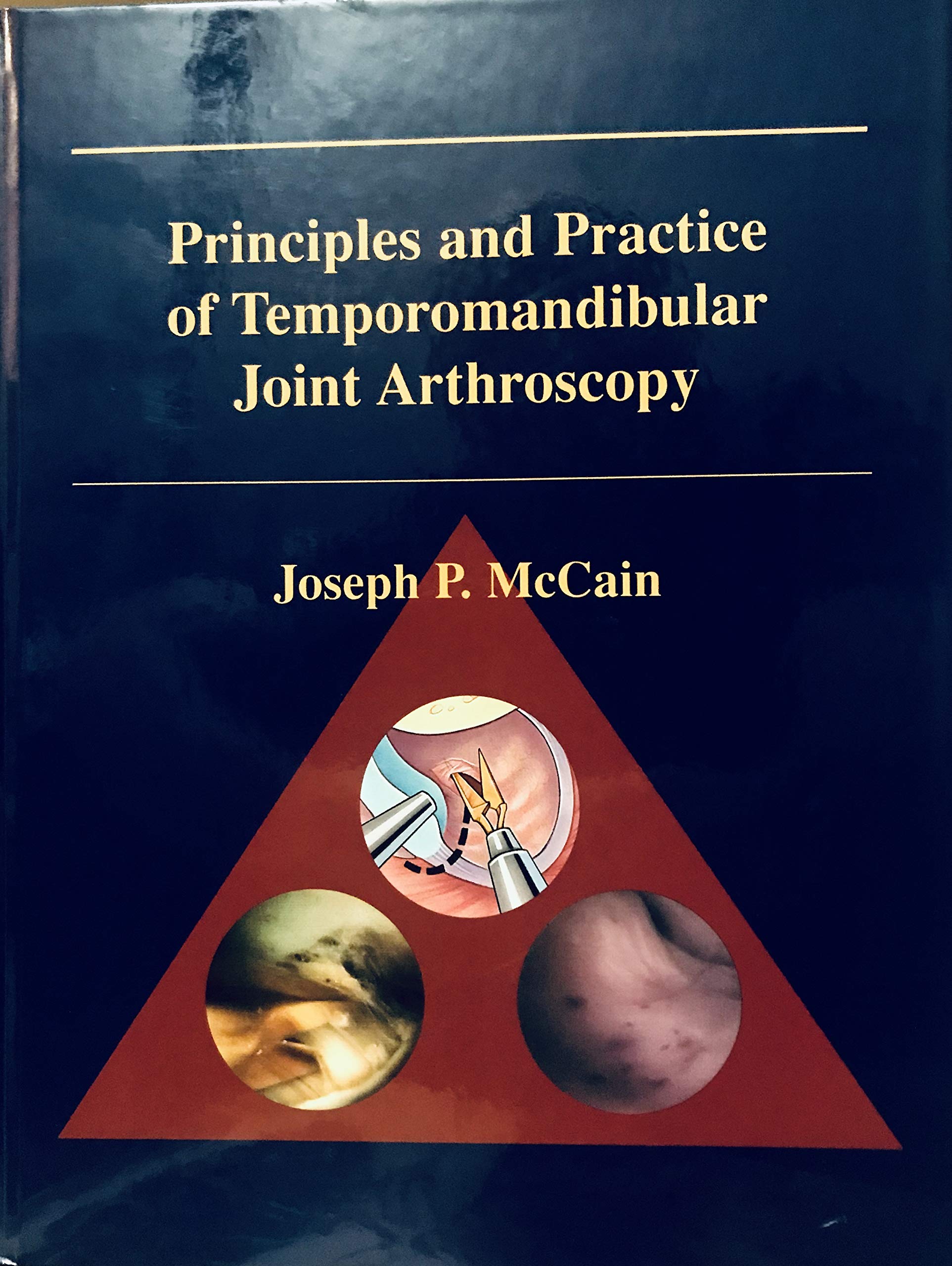 Principles And Practice Of Temporomandibular Joint Arthroscopy