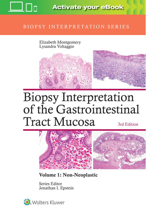 Biopsy Interpretation of the Gastrointestinal Tract Mucosa: Volume 1: NonNeoplastic (Biopsy Interpretation Series)