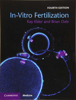 InVitro Fertilization,Used