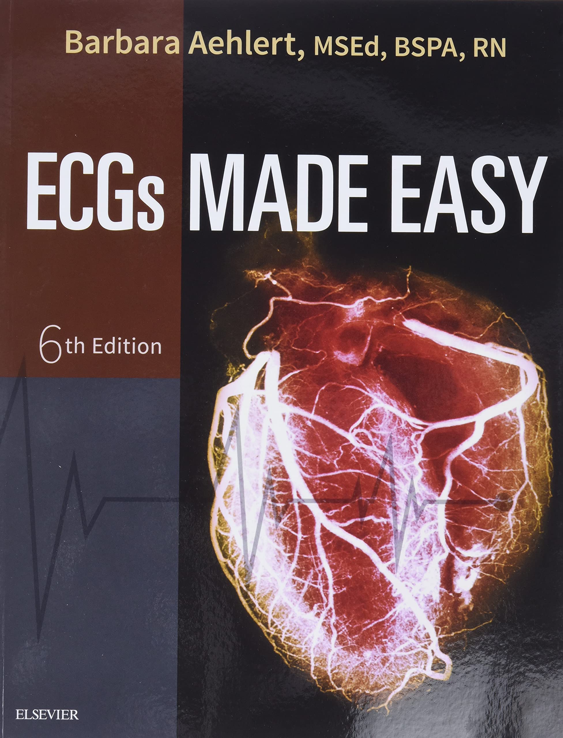 Ecgs Made Easy