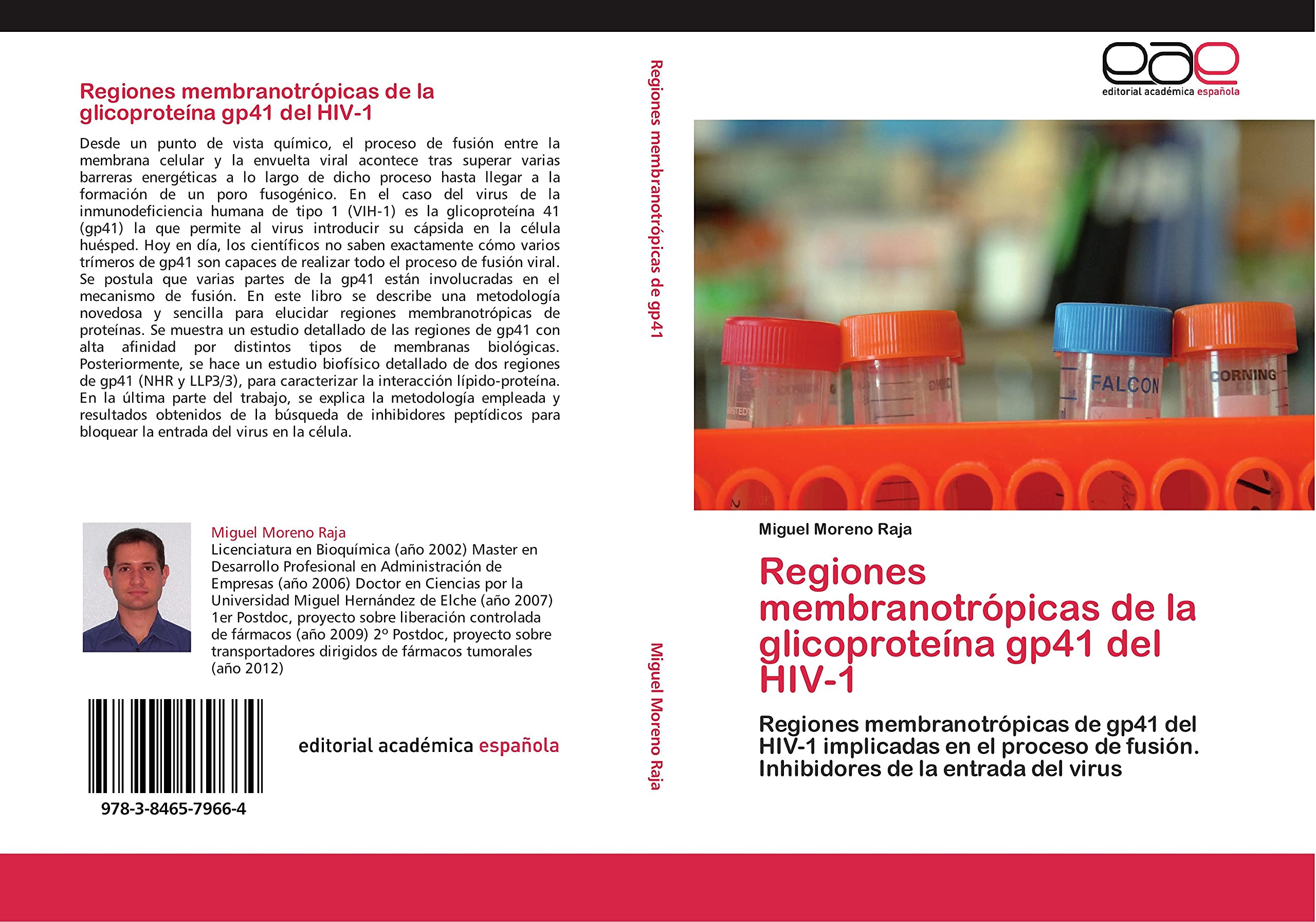 Regiones membranotrpicas de la glicoprotena gp41 del HIV1: Regiones membranotrpicas de gp41 del HIV1 implicadas en el pr,Used