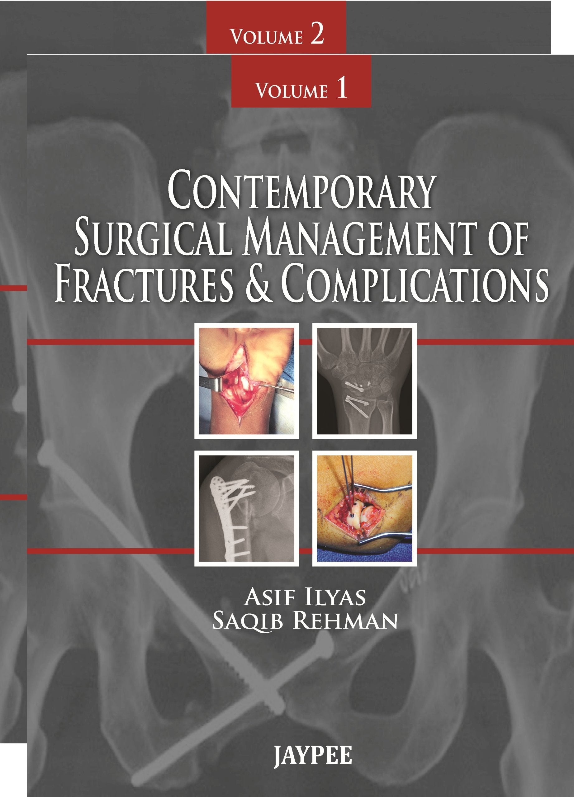Contemporary Surgical Management Of Fractures And Complications,Used
