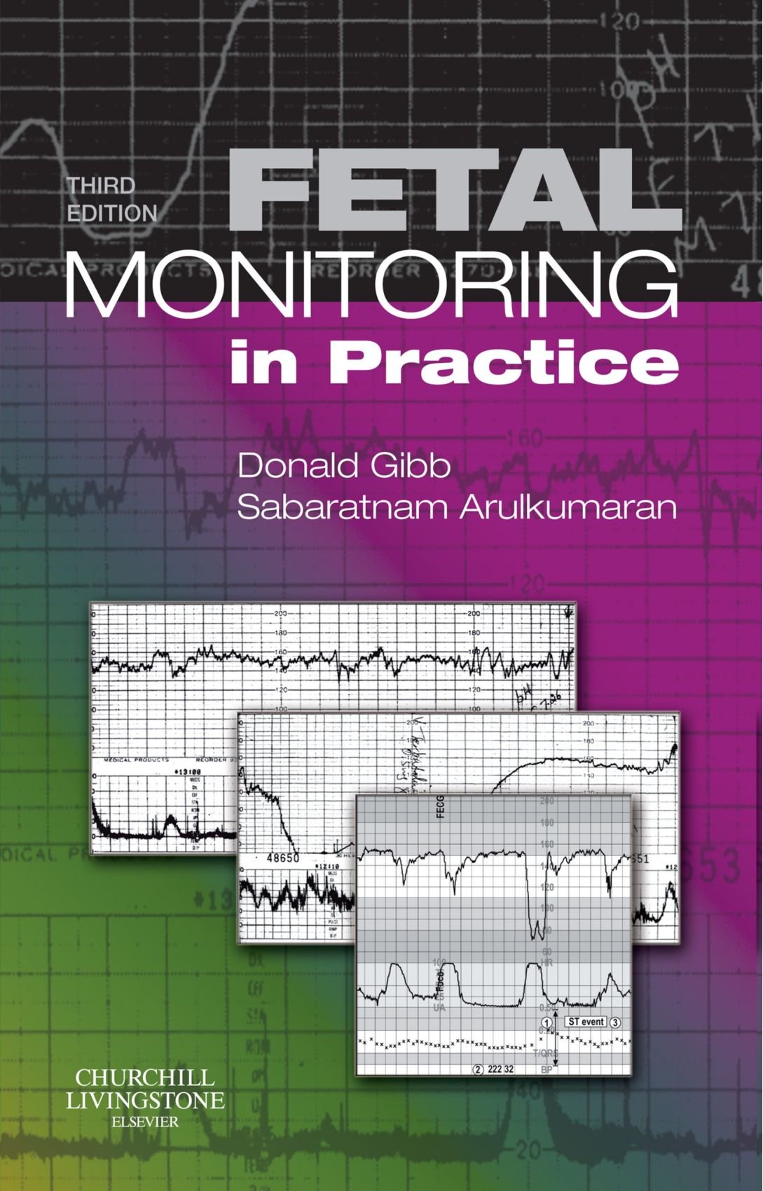 Fetal Monitoring in Practice,Used