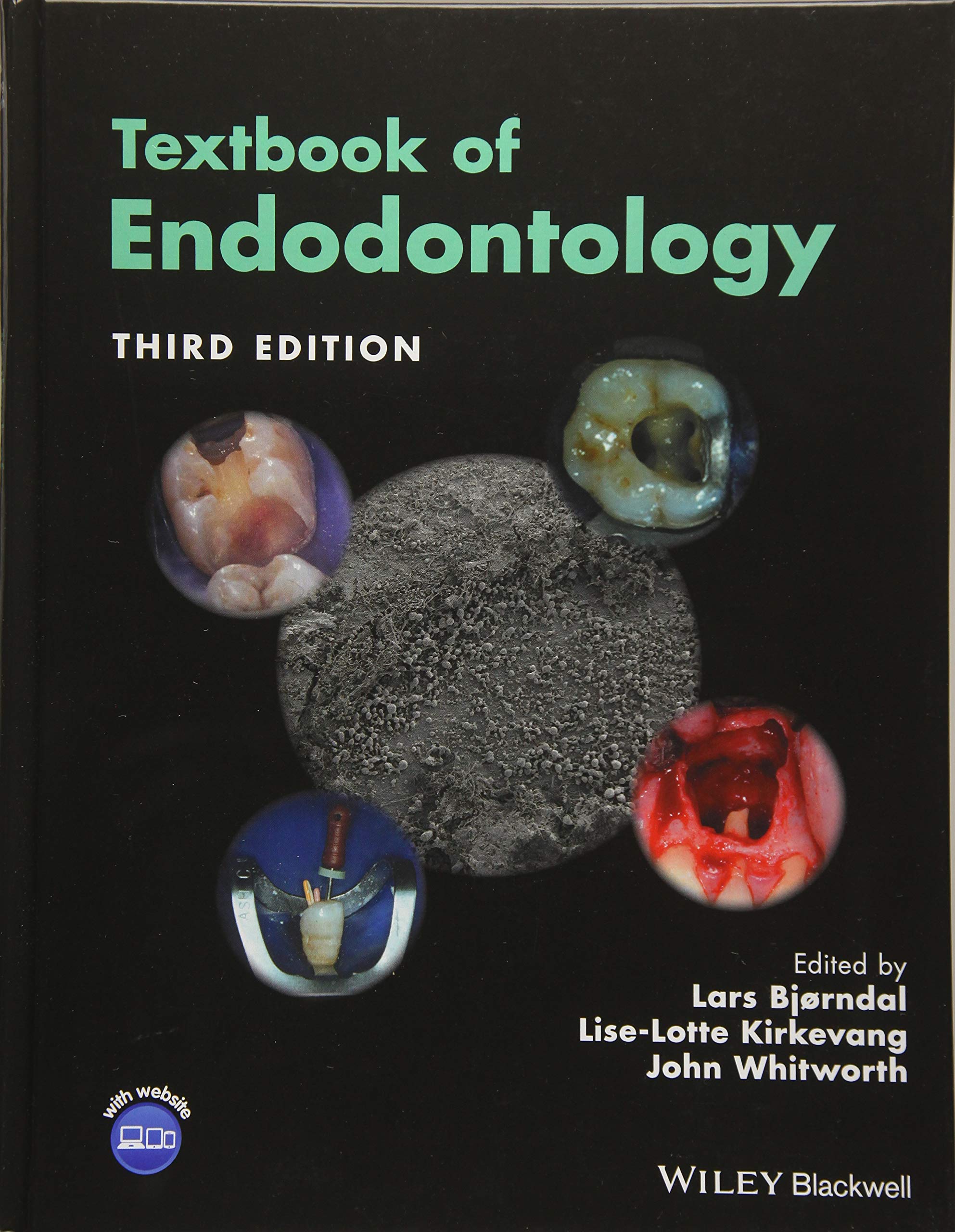 Textbook of Endodontology,Used