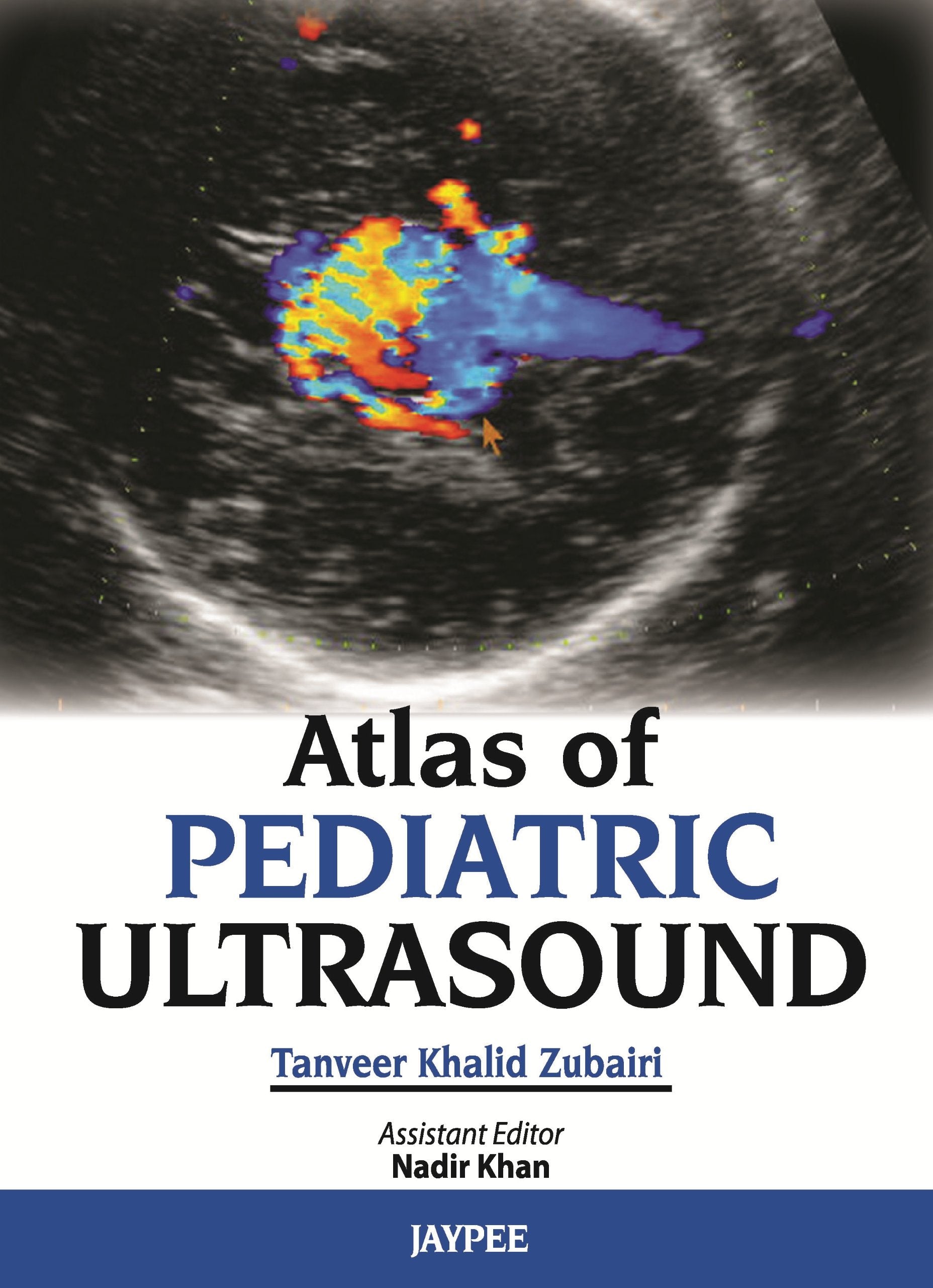 Atlas of Pediatric Ultrasound,Used